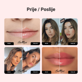 Alternative view of Set za povećanje usana s đumbirom i mentom BULKLIPS
