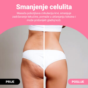 Alternative view of GUASHA – masažni valjak za oblikovanje tijela za vidljivo smanjenje celulita i masnoće